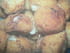 Boulettes picardes